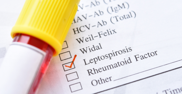 AWAS LEPTOSPIROSIS! KENALI GEJALA DAN CARA PENCEGAHAN